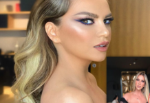 “Ku e ke dorën more”, ndjekësit pyesin Leonora Jakupin ku e ‘zhduku’ krahun